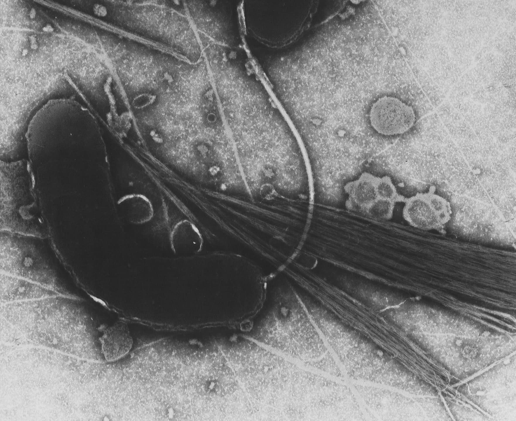 Transmission electron microscope image of Vibrio cholerae bacteria.