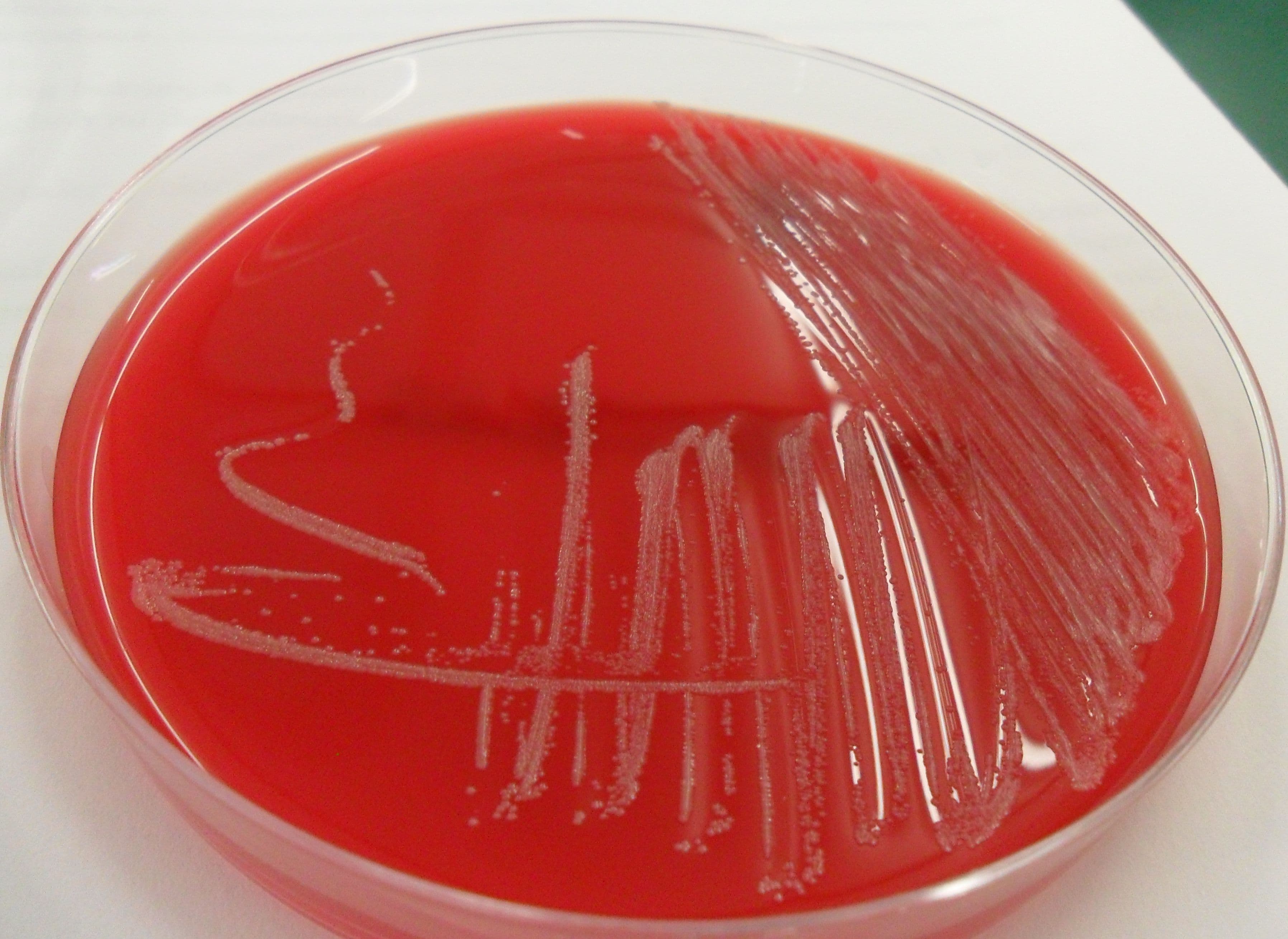 Microscope image of Corynebacterium diphtheriae bacteria.