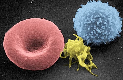 Scanning electron micrograph showing red blood cells and a white blood cell.