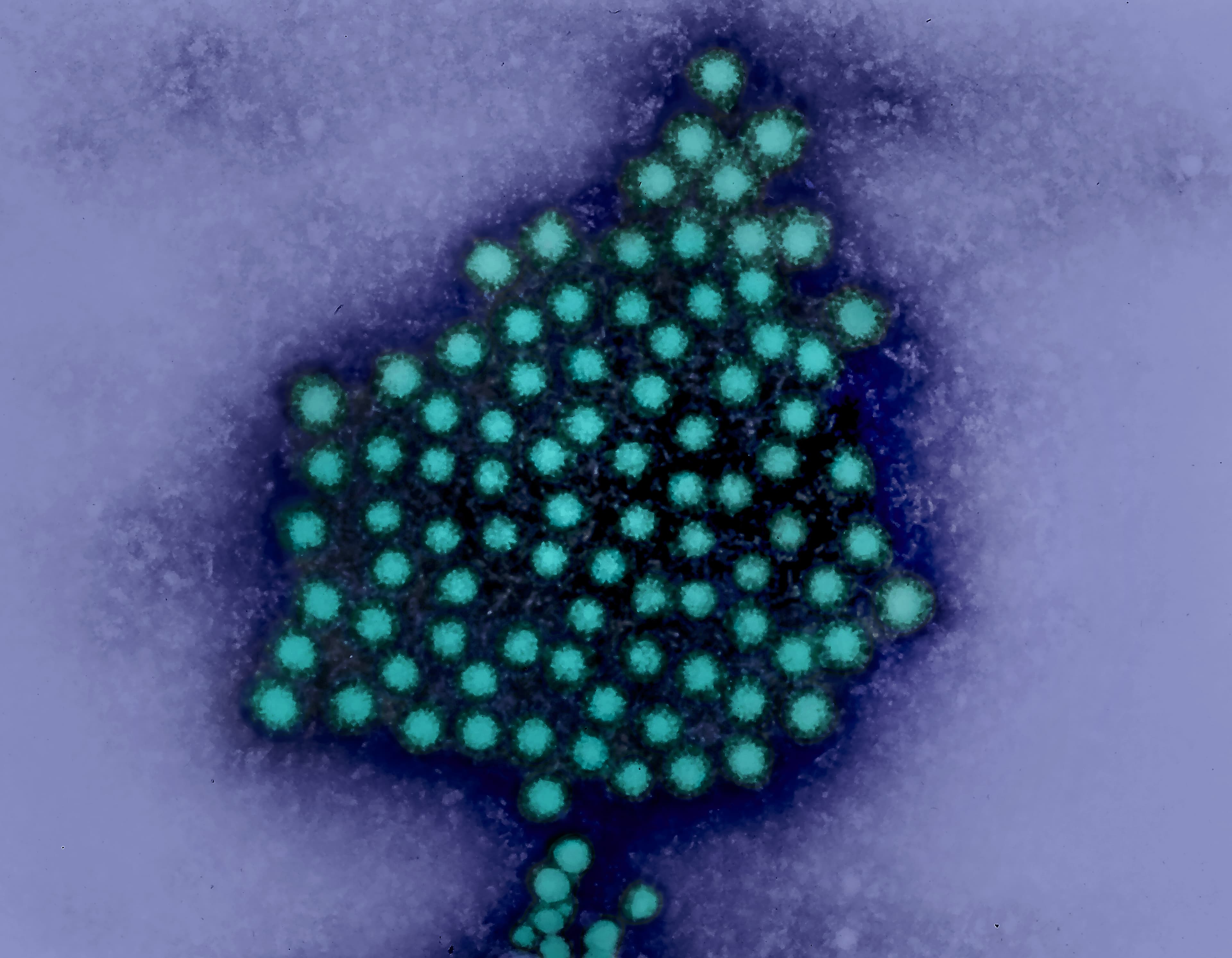 Colorized micrograph showing hepatitis A virus particles.