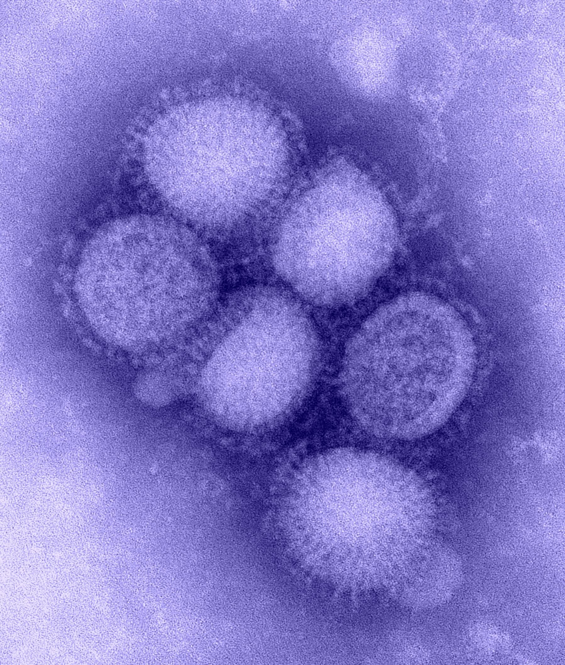 Electron microscope image of H1N1 influenza virus particles.