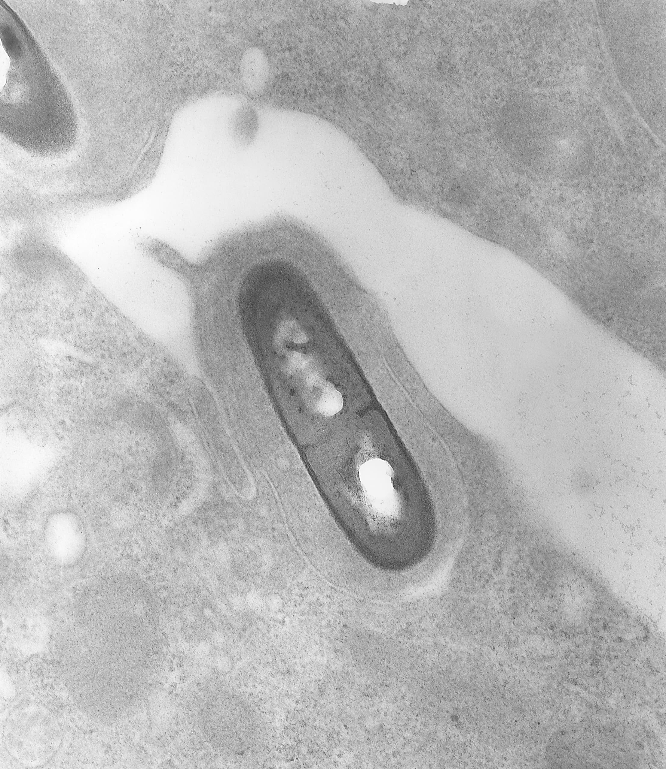 Electron micrograph of Listeria monocytogenes bacteria in tissue.