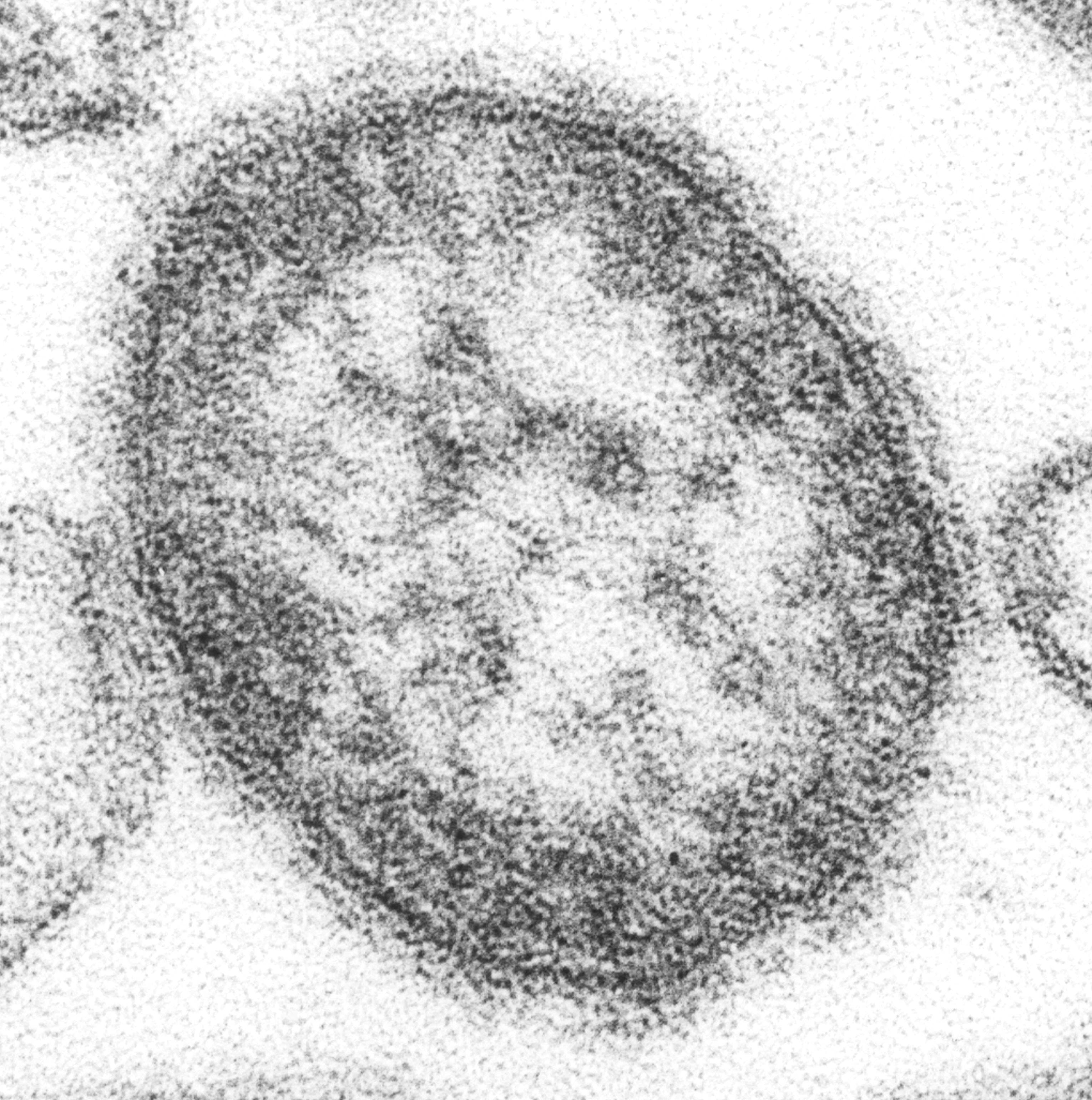Electron microscope image of measles virus particles.