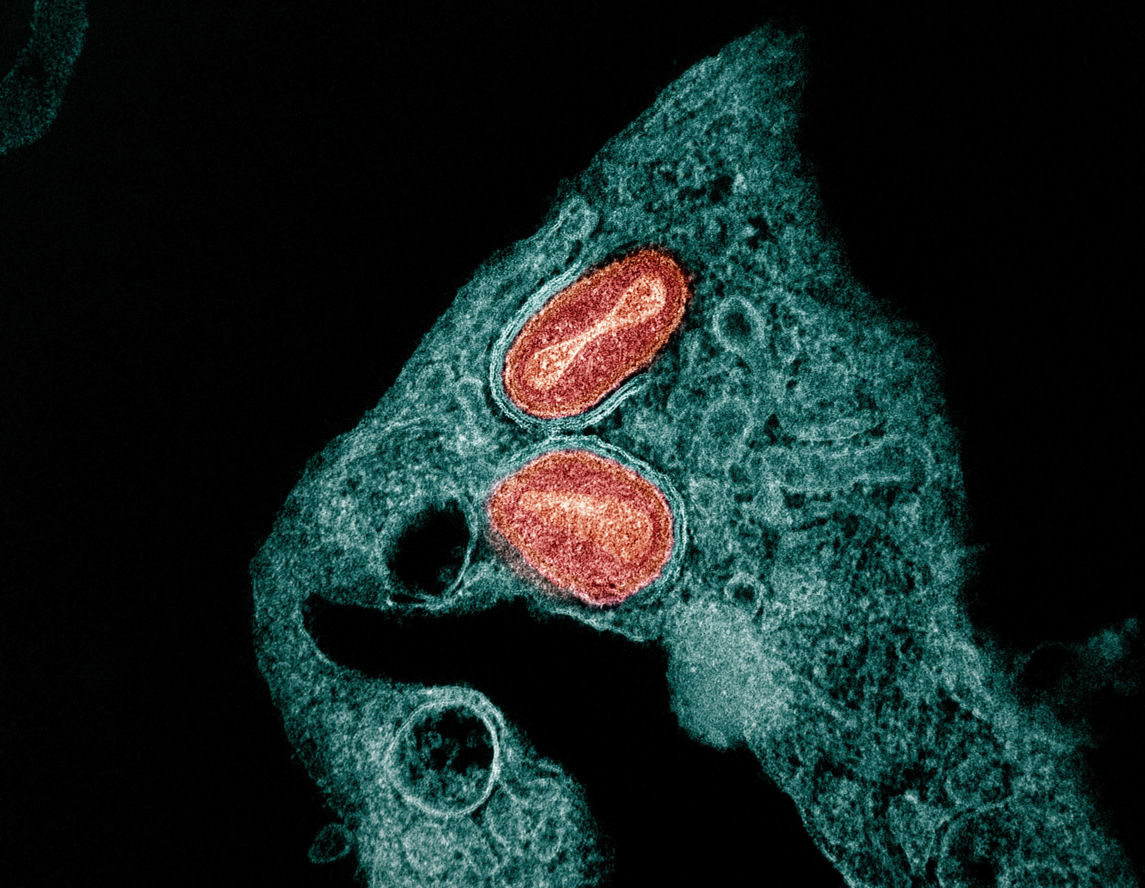 Colorized transmission electron micrograph showing mpox virus particles.