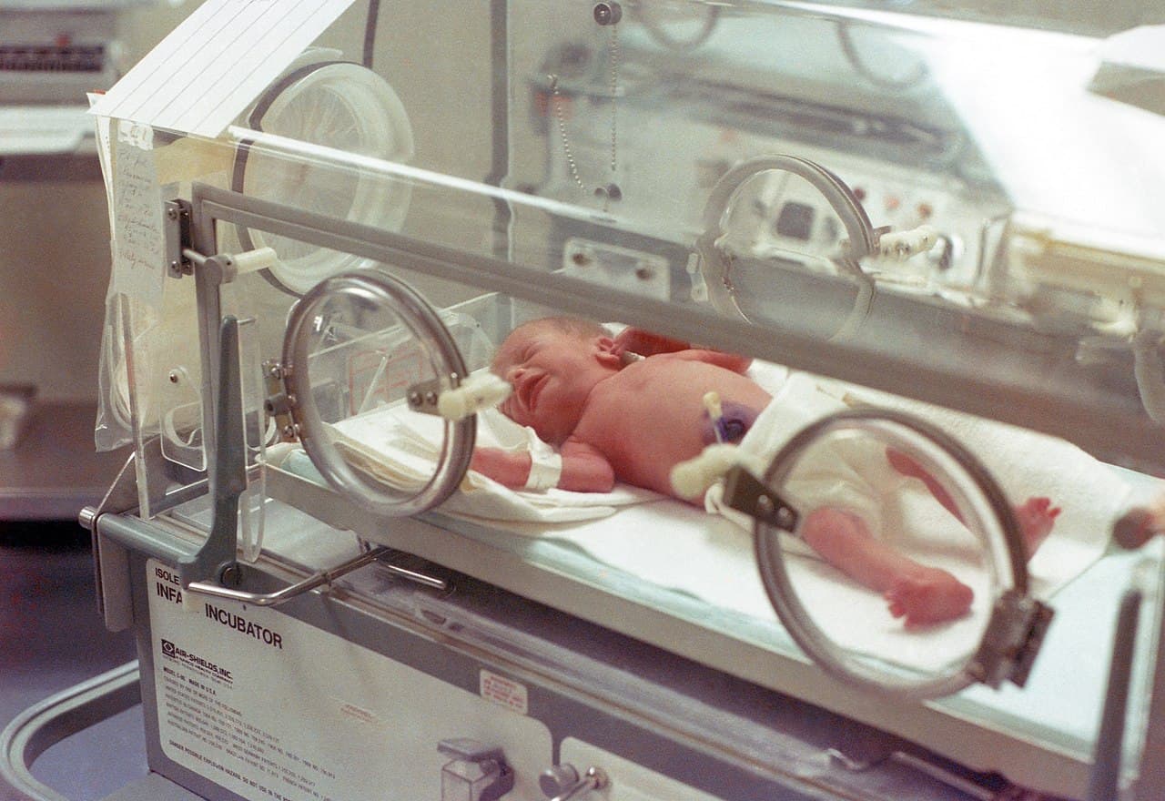 A premature newborn lies inside a neonatal incubator in a hospital care setting.