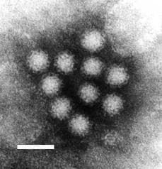 Electron micrograph image of Norwalk virus particles, a type of norovirus.