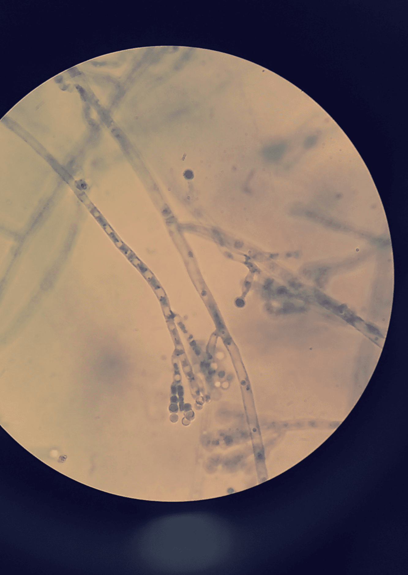 Microscope image of Penicillium notatum mold stained blue
