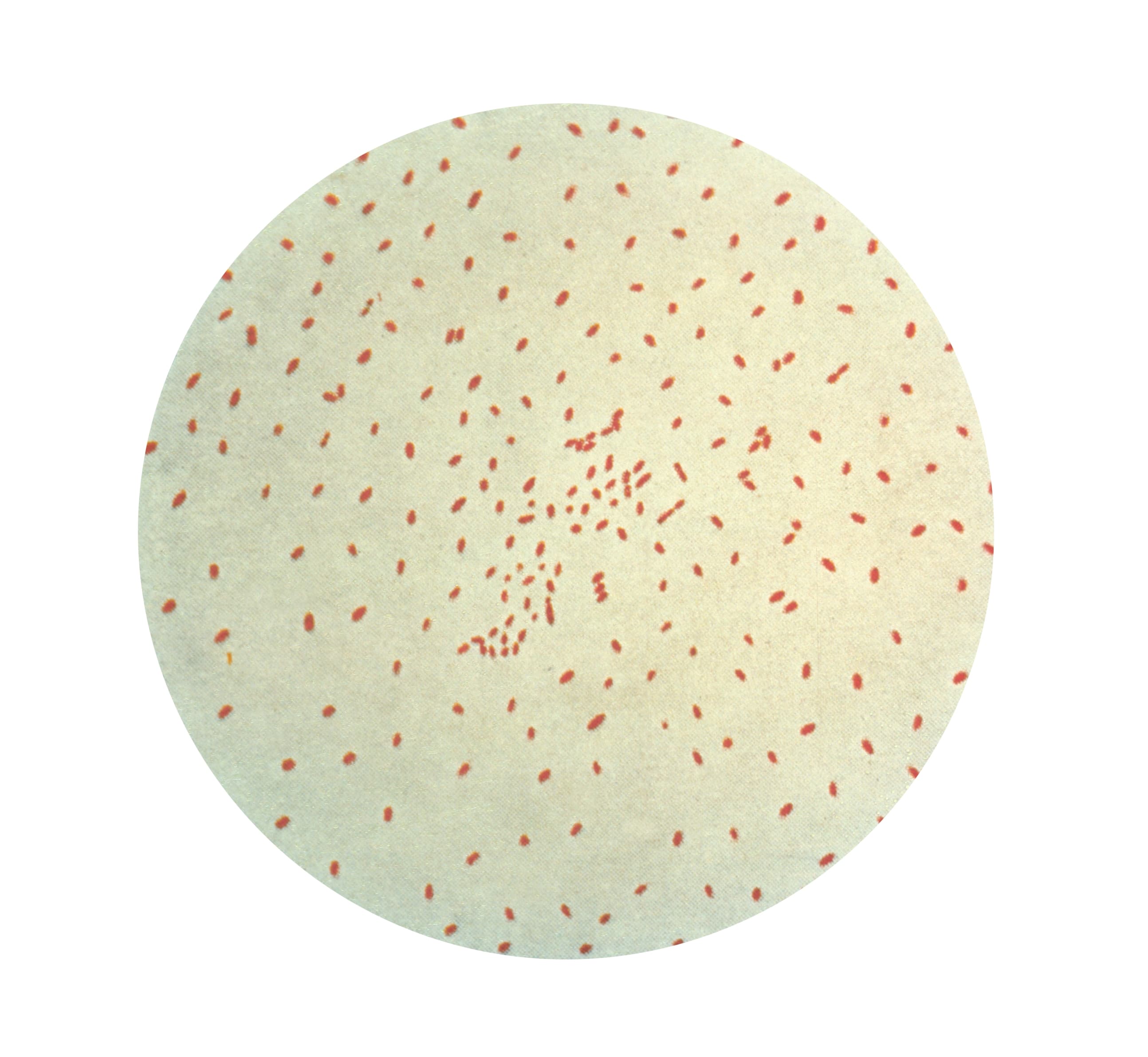 Gram stain micrograph of Bordetella pertussis bacteria.