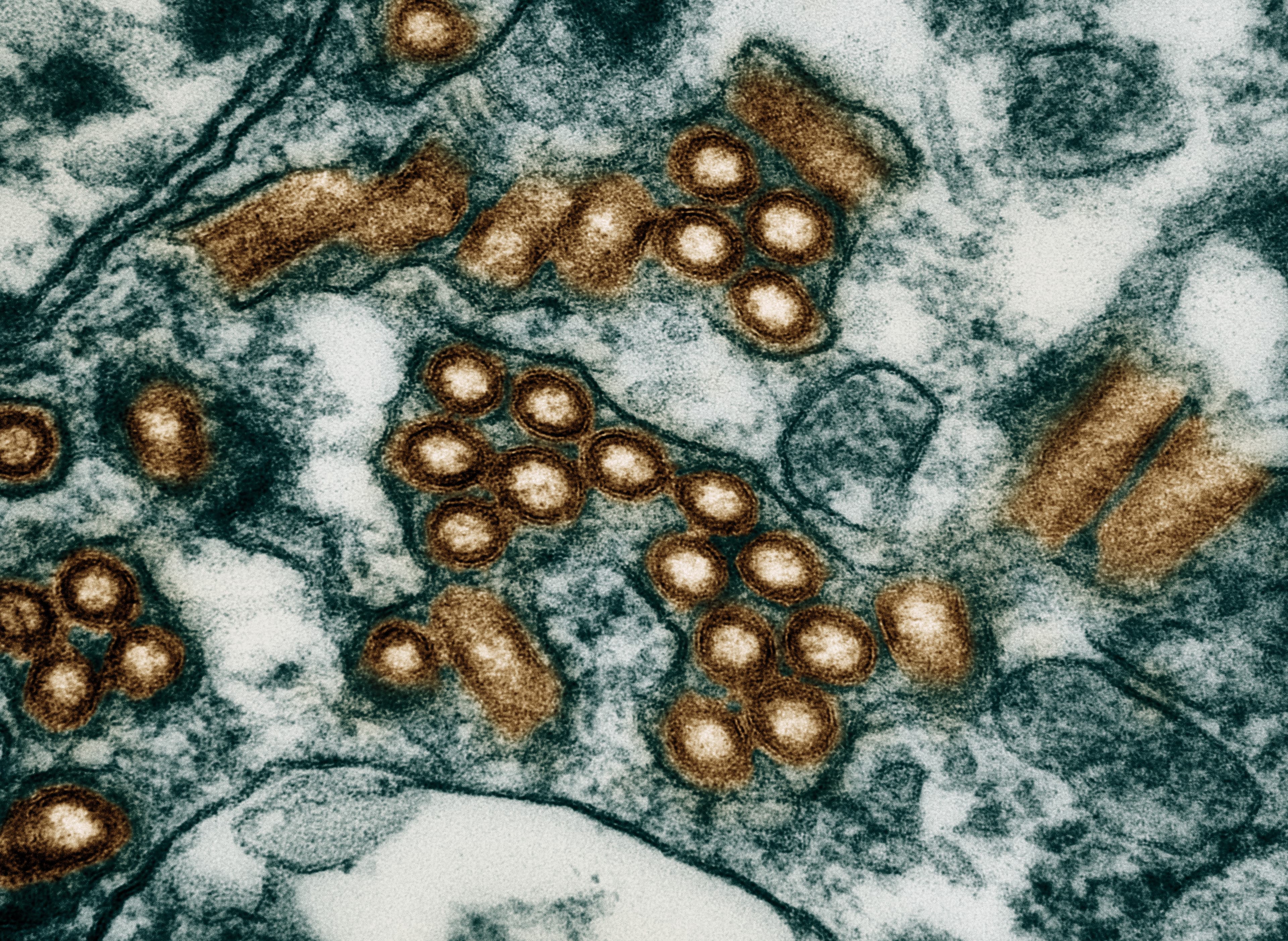 Colorized transmission electron micrograph of rabies virus particles in an infected cell.