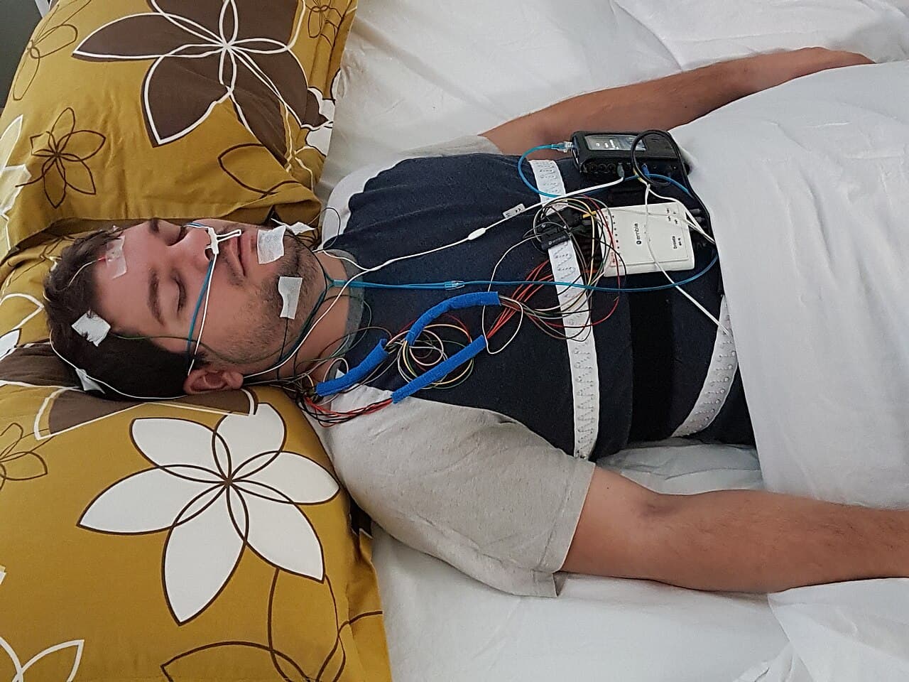 A person prepared for polysomnography with sleep study sensors attached.