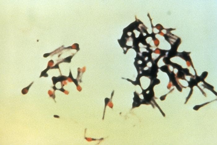 Micrograph showing Clostridium tetani bacteria.