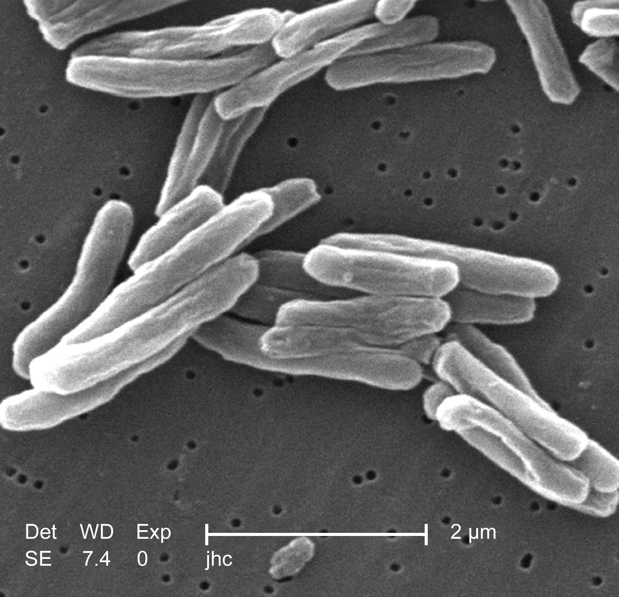 Microscope image of red-stained Mycobacterium tuberculosis bacteria.