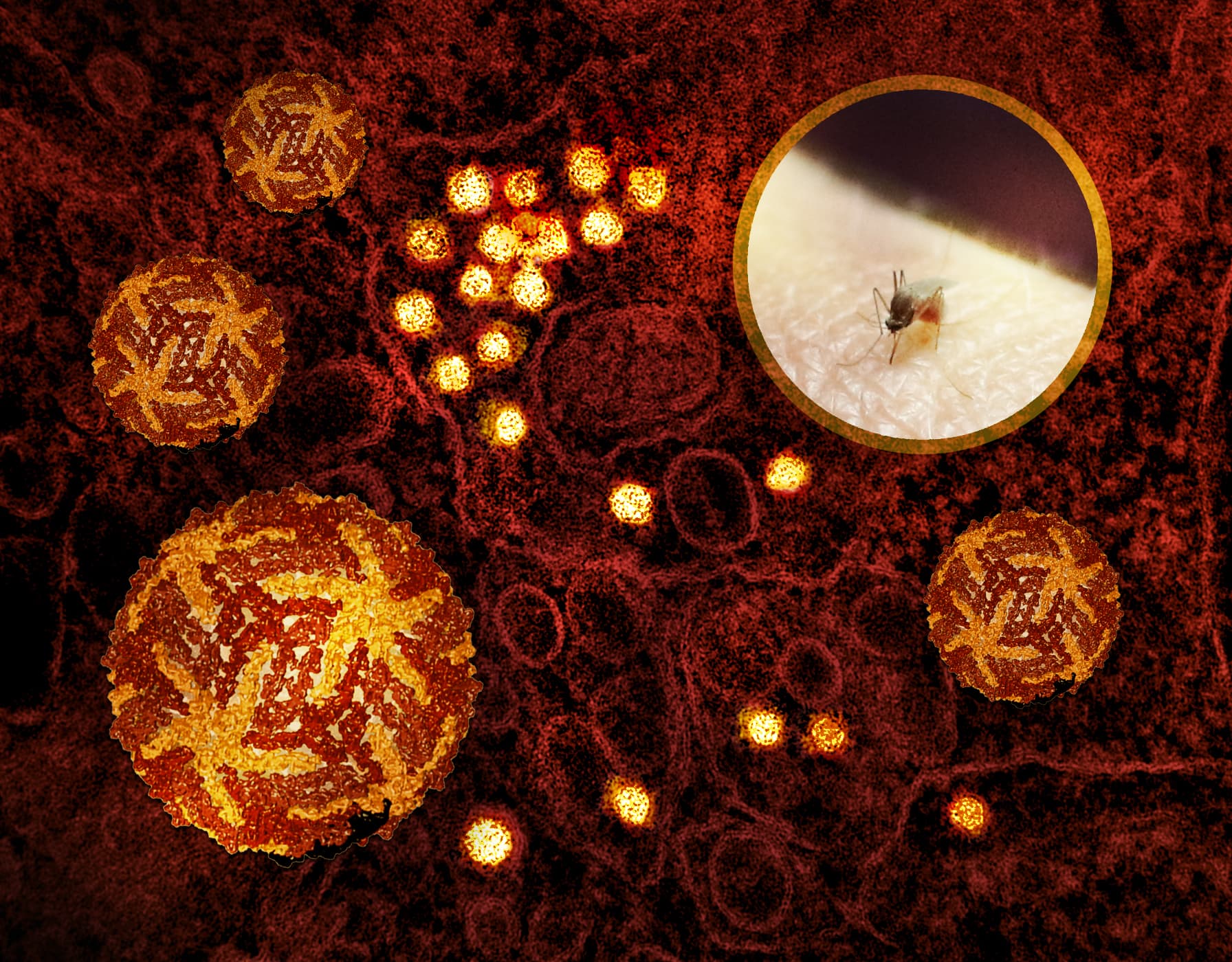 Composite image showing a Culex mosquito, West Nile virus models, and a micrograph of virus particles.