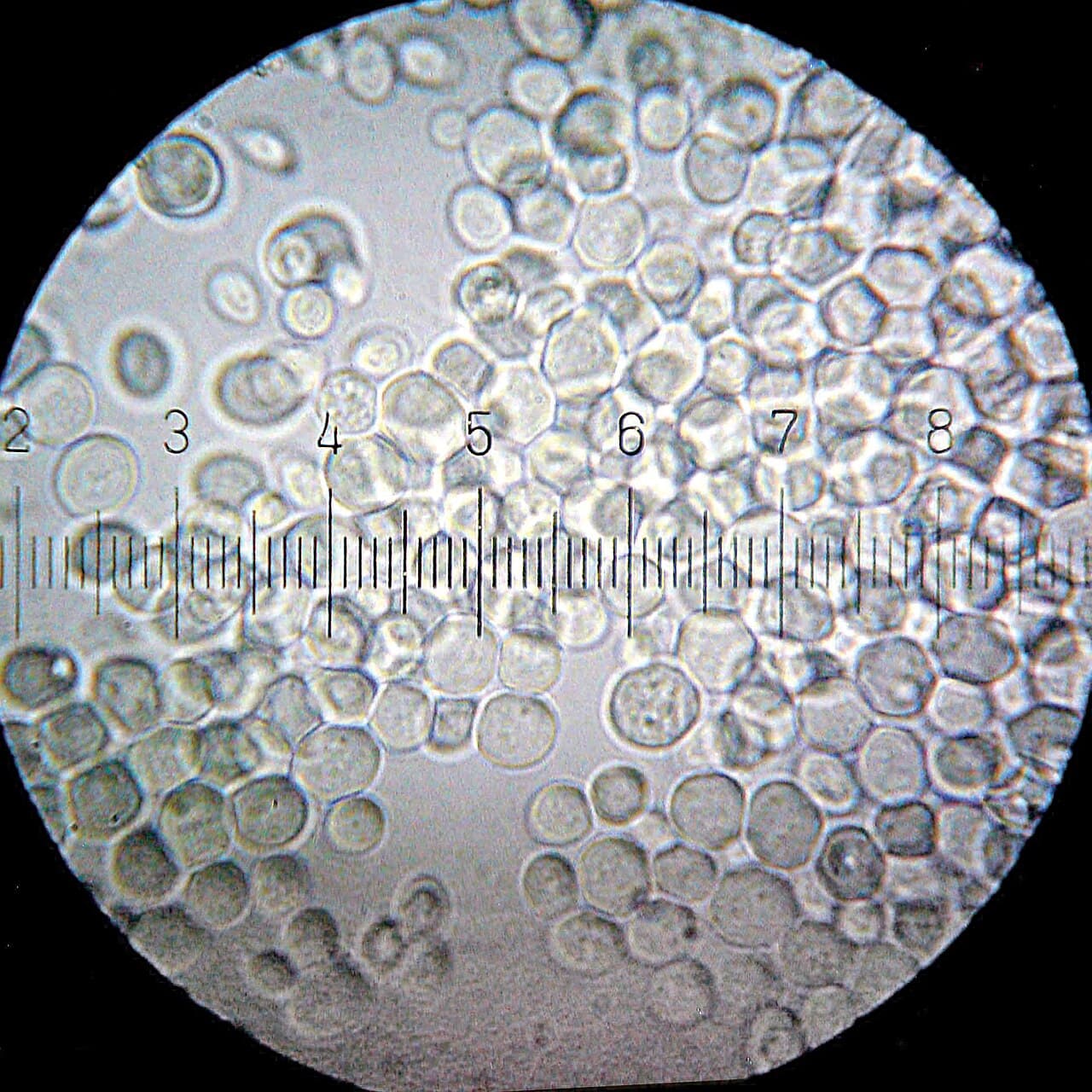 Baker's yeast cells seen under a microscope.