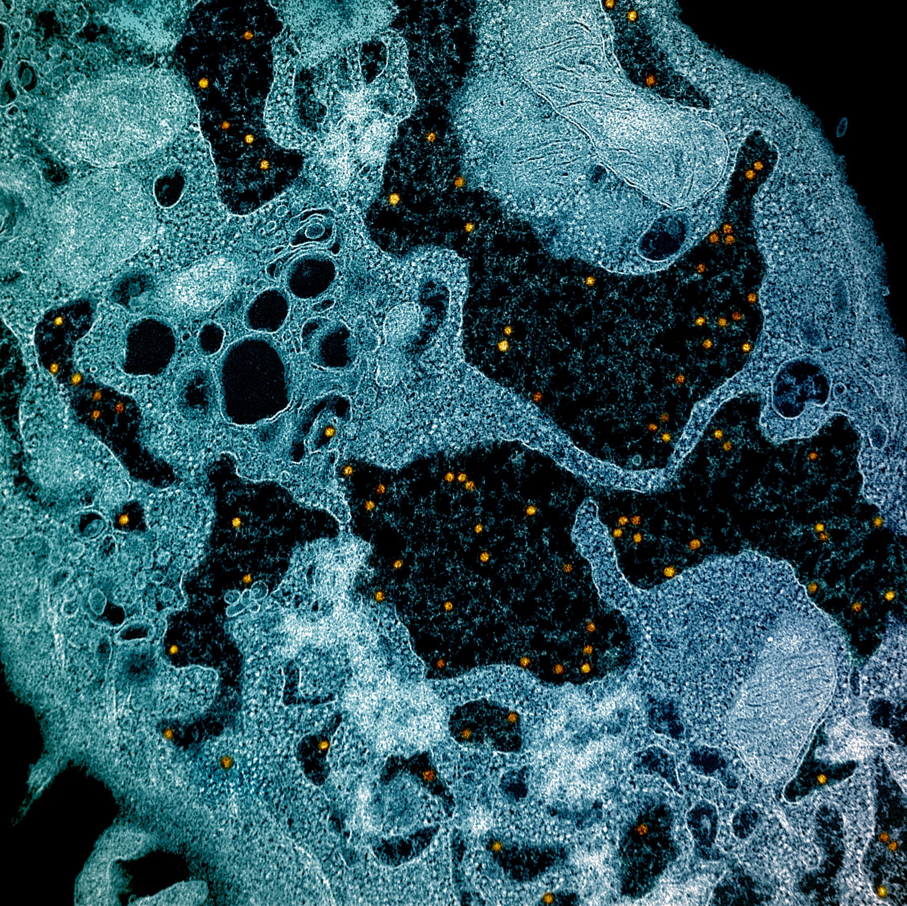 Colorized microscope image of yellow fever virus particles.