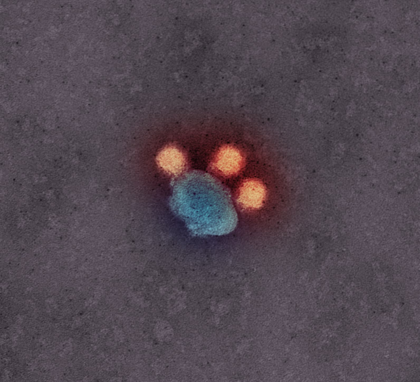 Colorized transmission electron micrograph of Zika virus particles.